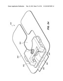 ANTI-BUCKLING MECHANISMS AND METHODS diagram and image