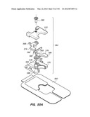 ANTI-BUCKLING MECHANISMS AND METHODS diagram and image