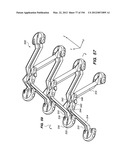 ANTI-BUCKLING MECHANISMS AND METHODS diagram and image