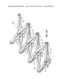 ANTI-BUCKLING MECHANISMS AND METHODS diagram and image