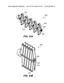 ANTI-BUCKLING MECHANISMS AND METHODS diagram and image