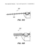 ANTI-BUCKLING MECHANISMS AND METHODS diagram and image