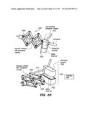 ANTI-BUCKLING MECHANISMS AND METHODS diagram and image