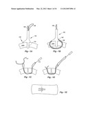 SOFT TISSUE REPAIR METHODS AND APPARATUS diagram and image