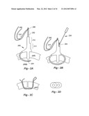 SOFT TISSUE REPAIR METHODS AND APPARATUS diagram and image