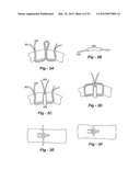 SOFT TISSUE REPAIR METHODS AND APPARATUS diagram and image