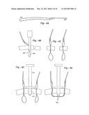 SOFT TISSUE REPAIR METHODS AND APPARATUS diagram and image