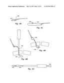 SOFT TISSUE REPAIR METHODS AND APPARATUS diagram and image