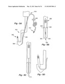 SOFT TISSUE REPAIR METHODS AND APPARATUS diagram and image