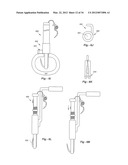 SOFT TISSUE REPAIR METHODS AND APPARATUS diagram and image