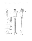 SOFT TISSUE REPAIR METHODS AND APPARATUS diagram and image