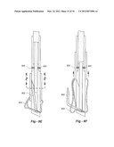 SOFT TISSUE REPAIR METHODS AND APPARATUS diagram and image