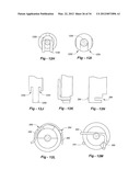 SOFT TISSUE REPAIR METHODS AND APPARATUS diagram and image