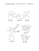 SOFT TISSUE REPAIR METHODS AND APPARATUS diagram and image