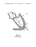 SYSTEM FOR PROVIDING SURGICAL ACCESS diagram and image