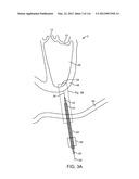 SYSTEM FOR PROVIDING SURGICAL ACCESS diagram and image