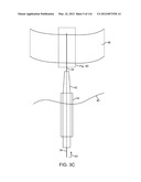 SYSTEM FOR PROVIDING SURGICAL ACCESS diagram and image