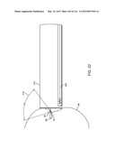 SYSTEM FOR PROVIDING SURGICAL ACCESS diagram and image