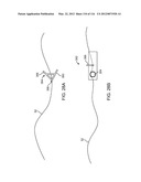 SYSTEM FOR PROVIDING SURGICAL ACCESS diagram and image