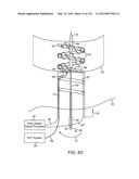 SYSTEM FOR PROVIDING SURGICAL ACCESS diagram and image