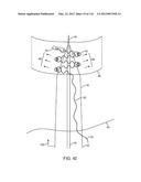 SYSTEM FOR PROVIDING SURGICAL ACCESS diagram and image