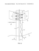 SYSTEM FOR PROVIDING SURGICAL ACCESS diagram and image