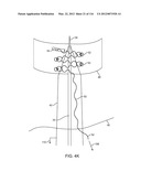 SYSTEM FOR PROVIDING SURGICAL ACCESS diagram and image