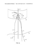 SYSTEM FOR PROVIDING SURGICAL ACCESS diagram and image