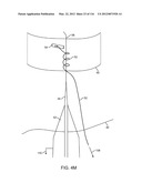 SYSTEM FOR PROVIDING SURGICAL ACCESS diagram and image