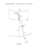 SYSTEM FOR PROVIDING SURGICAL ACCESS diagram and image