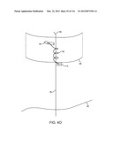 SYSTEM FOR PROVIDING SURGICAL ACCESS diagram and image