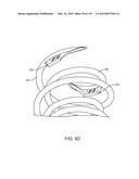 SYSTEM FOR PROVIDING SURGICAL ACCESS diagram and image