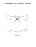 SYSTEM FOR PROVIDING SURGICAL ACCESS diagram and image