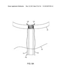 SYSTEM FOR PROVIDING SURGICAL ACCESS diagram and image