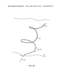 SYSTEM FOR PROVIDING SURGICAL ACCESS diagram and image