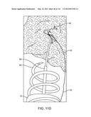 SYSTEM FOR PROVIDING SURGICAL ACCESS diagram and image