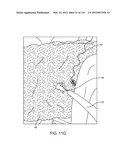 SYSTEM FOR PROVIDING SURGICAL ACCESS diagram and image