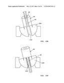 LOCKING PLATES HAVING GUIDED LOCKING SCREWS AND METHODS THEREFOR diagram and image