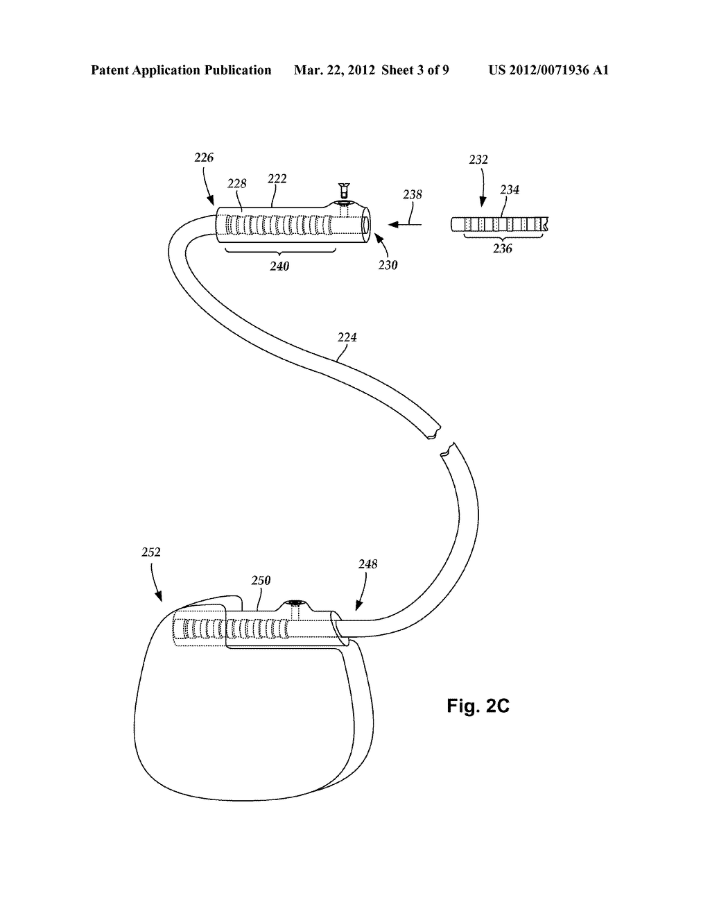 SYSTEMS AND METHODS FOR MAKING AND USING PADDLE LEADS WITH ADJUSTABLE     SPACING BETWEEN ADJACENT ELECTRODES - diagram, schematic, and image 04