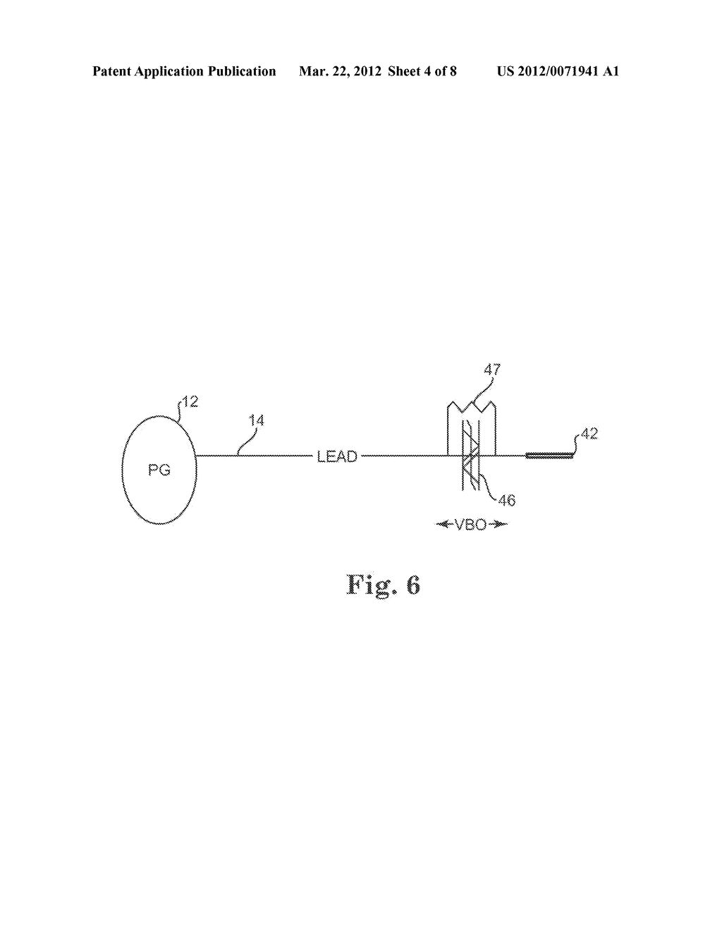 SELECTIVELY CONNECTING THE TIP ELECTRODE DURING THERAPY FOR MRI SHIELDING - diagram, schematic, and image 05