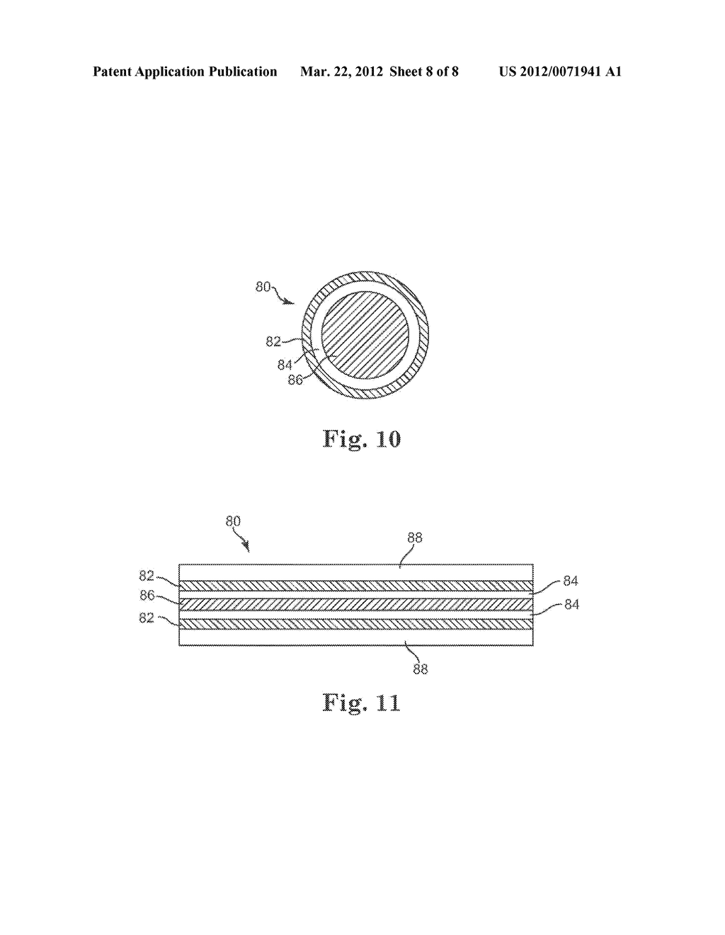 SELECTIVELY CONNECTING THE TIP ELECTRODE DURING THERAPY FOR MRI SHIELDING - diagram, schematic, and image 09