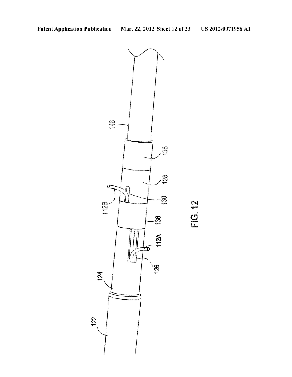 Medical Leads and Related Systems that Include a Lumen Body That Is Joined     to a Lead Body and That Has Multiple Filar Lumens - diagram, schematic, and image 13