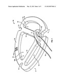 ROBOTIC HEART VALVE ANNULUS SIZER diagram and image
