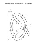 ROBOTIC HEART VALVE ANNULUS SIZER diagram and image