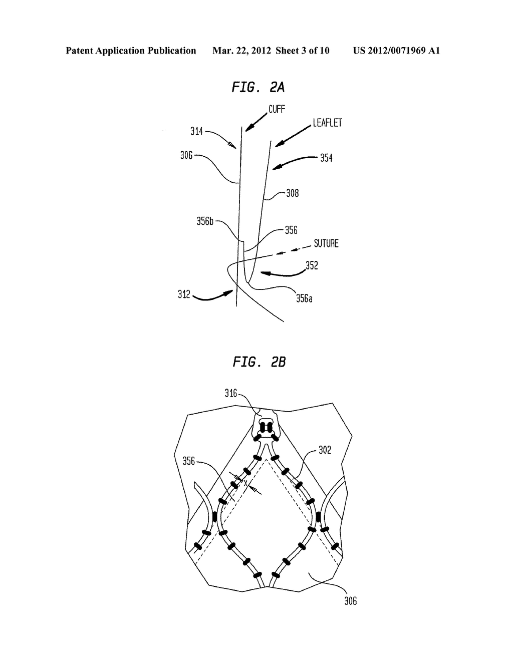 VALVE LEAFLET ATTACHMENT IN COLLAPSIBLE PROSTHETIC VALVES - diagram, schematic, and image 04