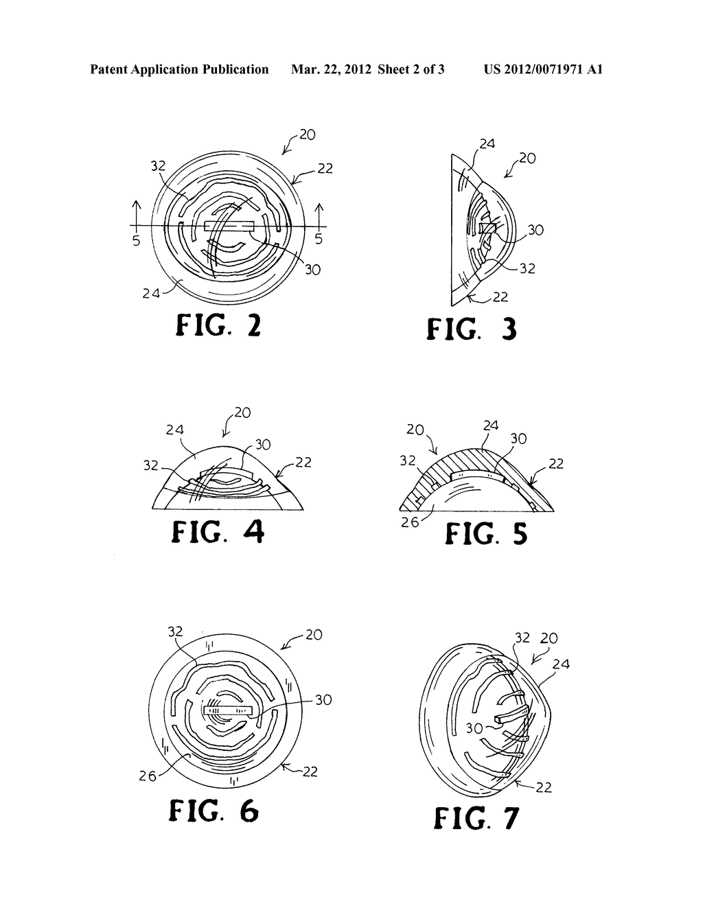 ARTIFICIAL EYE AND METHOD OF MANUFACTURE - diagram, schematic, and image 03