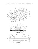 DISTRACTIBLE INTERVERTEBRAL IMPLANT diagram and image