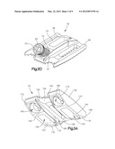 DISTRACTIBLE INTERVERTEBRAL IMPLANT diagram and image