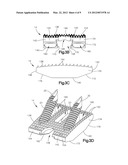 DISTRACTIBLE INTERVERTEBRAL IMPLANT diagram and image