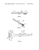 Methods and Systems for Interbody Implant and Bone Graft Delivery diagram and image